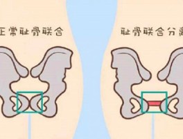 耻骨联合处疼痛原因(耻骨联合处疼痛原因分析)