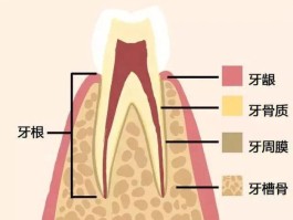 牙周病是怎么引起的(牙周病是怎么引起的?)