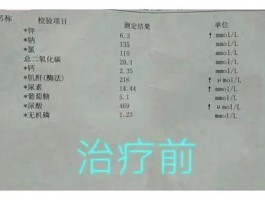 慢性肾功能不全怎么治疗(慢性肾功能不全怎么治疗最好)