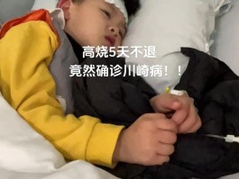 川崎病是什么原因引起的(川崎病是什么原因引起的有什么症状)