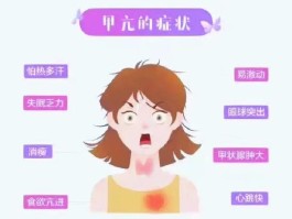 甲状腺亢进怎么检查(甲状腺亢进怎么检查确诊)