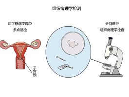 组织学检查是什么意思(组织学检查怎么做)