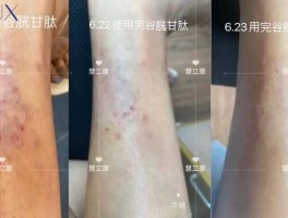 免疫系统紊乱怎么办(免疫系统紊乱怎么办?如何提高免疫系统)