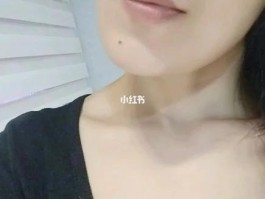 甲状腺亢进严重吗能治好不(女性甲状腺自检方法)