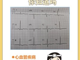 心律失常是什么